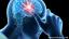 Wat te weten over epilepsie en geestelijke gezondheid